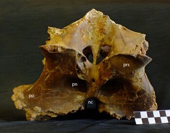 Osteoporosia JP Cr340.jpeg